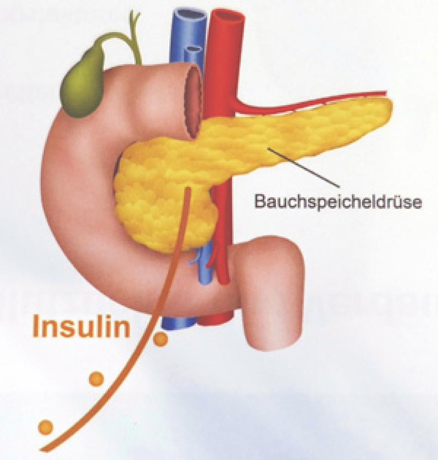 Diabetes, Endokrinologie